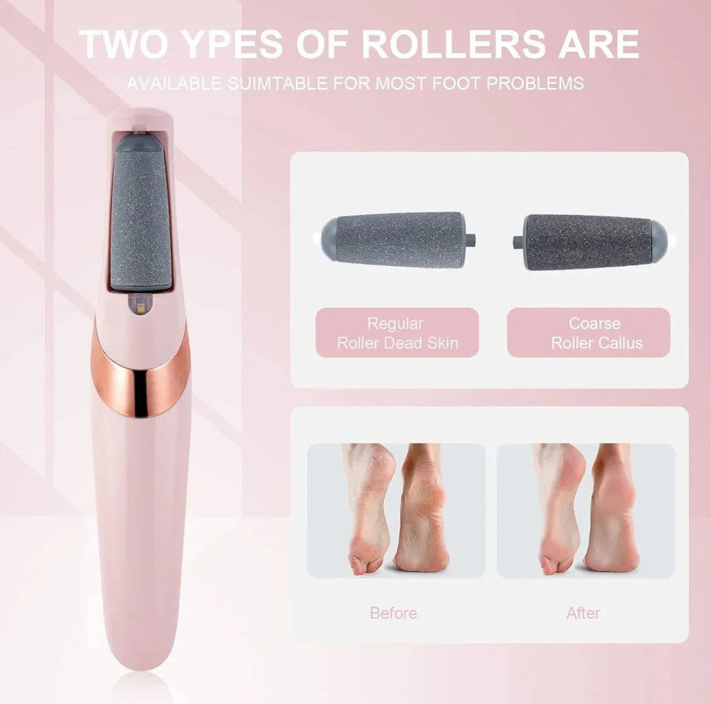 Electric Callus Remover – Smooth Feet, Effortlessly!