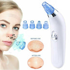 Derma  Blackhead Remover Device